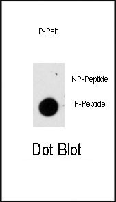 Phospho-GFAP (Ser8) Antibody in Dot Blot (DB)
