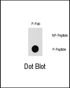 Phospho-PAK1 (Thr212) Antibody in Dot Blot (DB)