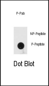 Phospho-PACT (Ser246) Antibody in Dot Blot (DB)