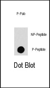 Phospho-c-Raf (Ser259) Antibody in Dot Blot (DB)