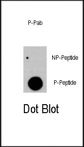 Phospho-c-Raf (Tyr341) Antibody in Dot Blot (DB)