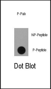Phospho-RSK1 (Ser363) Antibody in Dot Blot (DB)