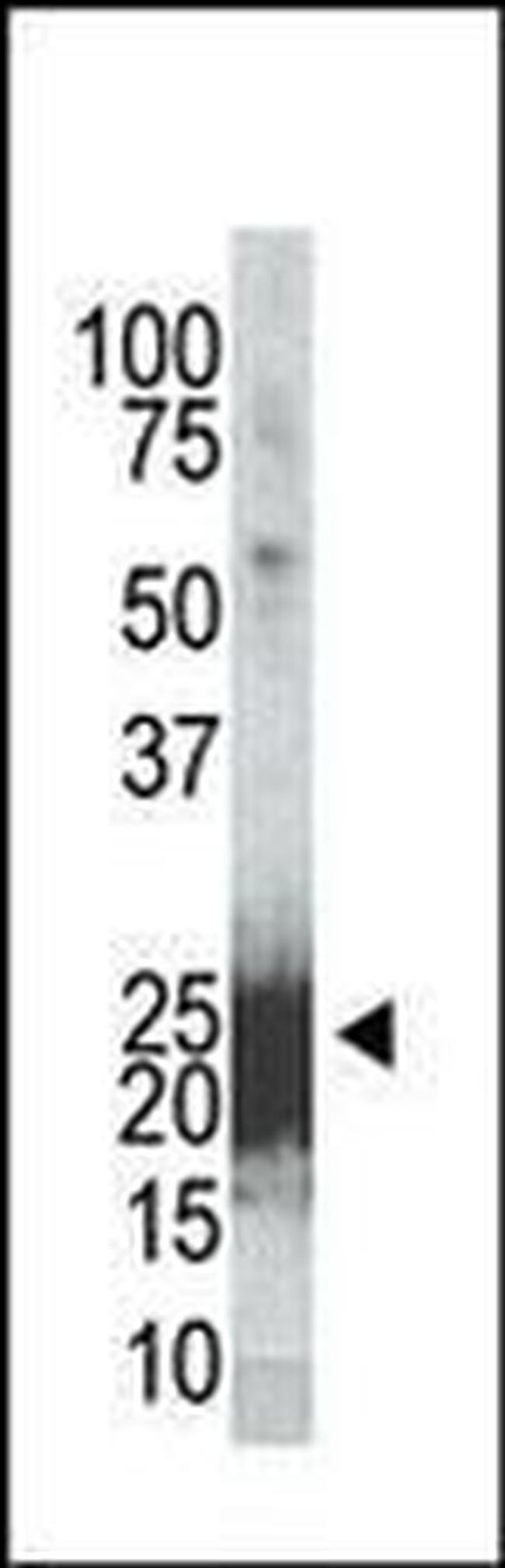 Phospho-BAD (Ser155) Antibody in Western Blot (WB)
