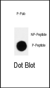 Phospho-p27 Kip1 (Thr198) Antibody in Dot Blot (DB)