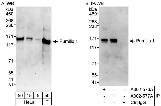 Pumilio 1 Antibody in Western Blot (WB)