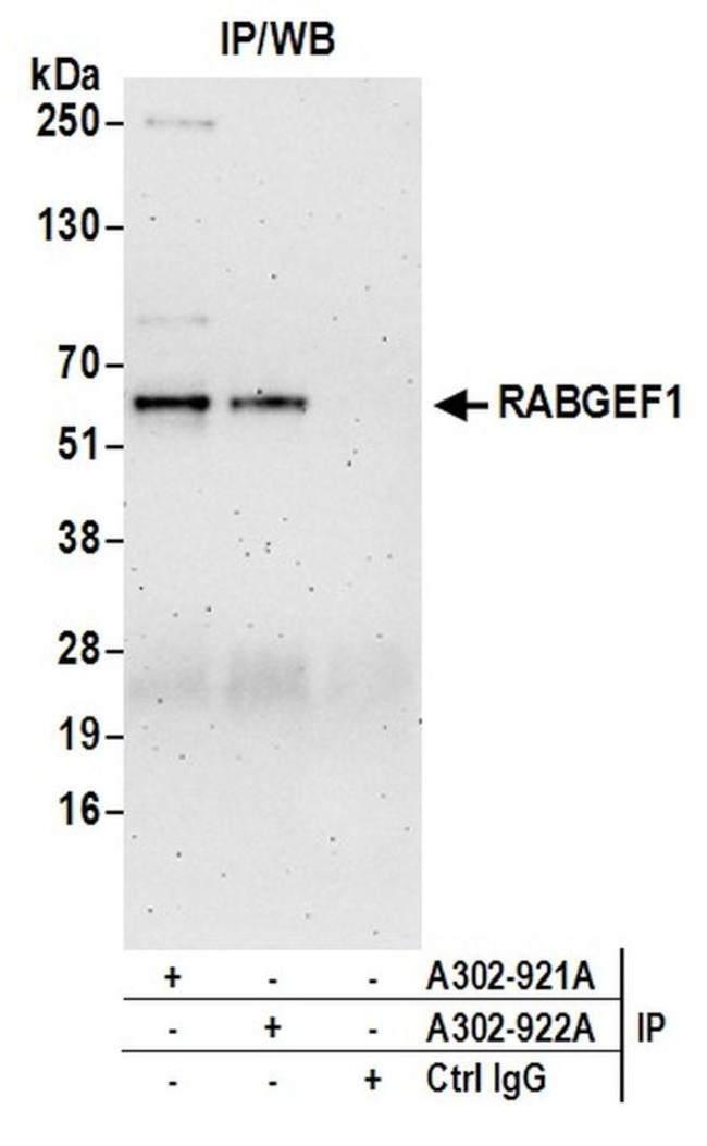 RABGEF1 Antibody in Immunoprecipitation (IP)