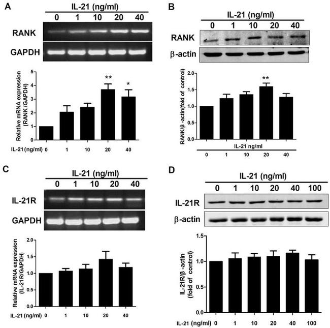 CD265 (RANK) Monoclonal Antibody (R12-31) (14-6612-82)