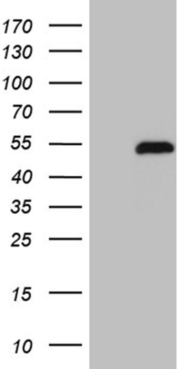 RARG Antibody in Western Blot (WB)