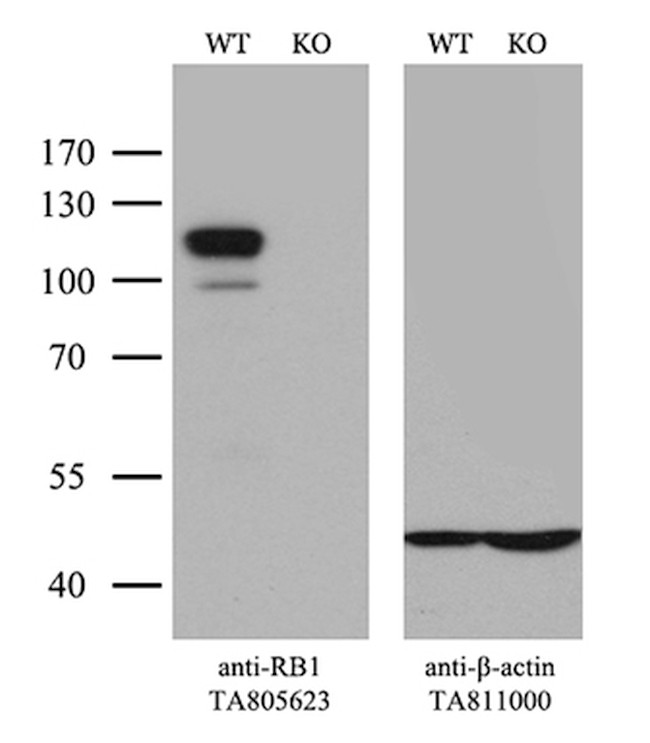 RB1 Antibody