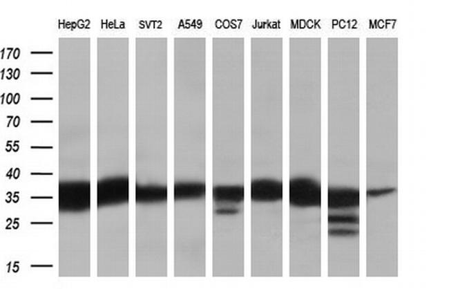 RDH11 Antibody in Western Blot (WB)