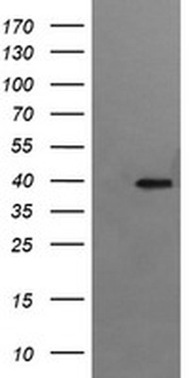 RFC4 Antibody in Western Blot (WB)