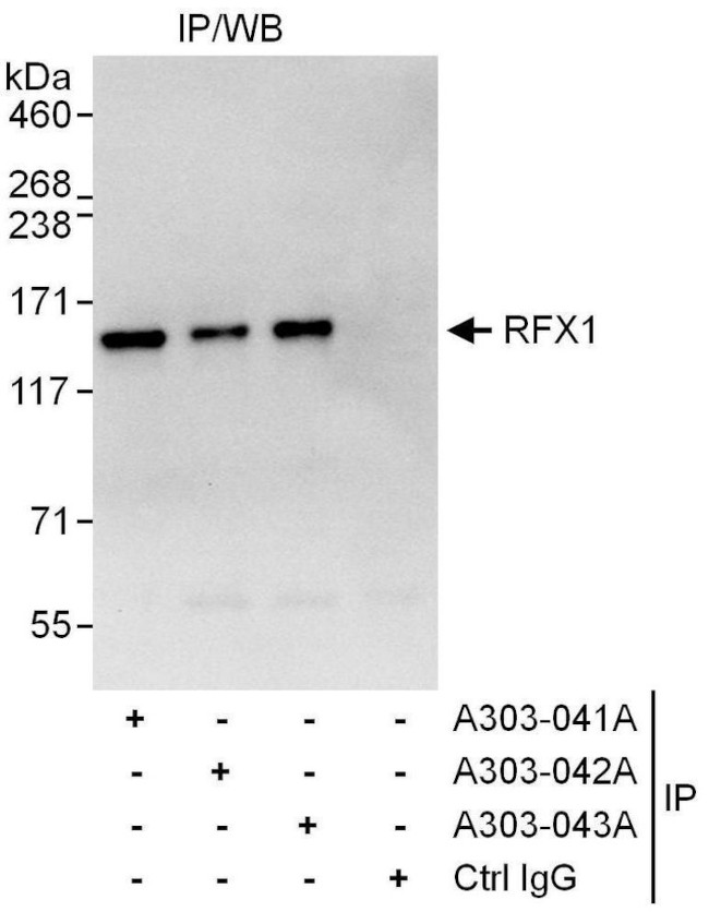 RFX1 Antibody in Immunoprecipitation (IP)