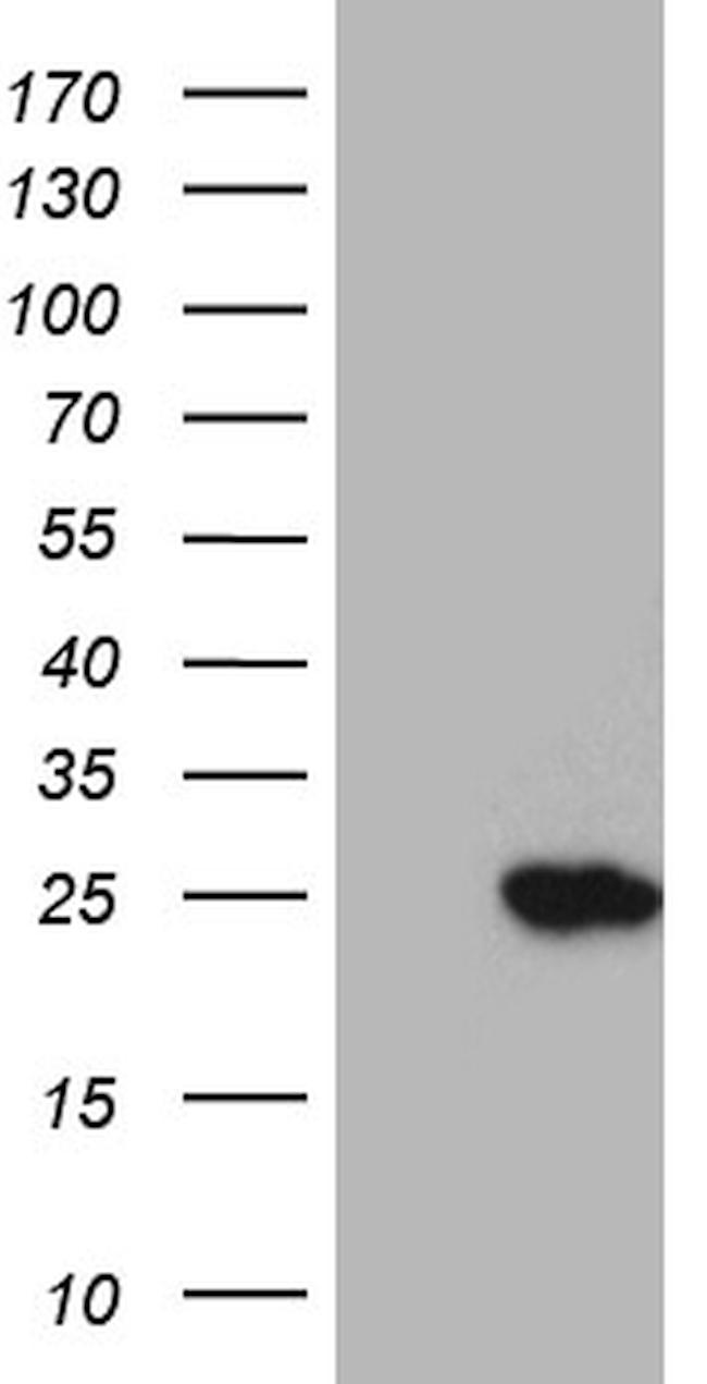 RGS10 Antibody in Western Blot (WB)