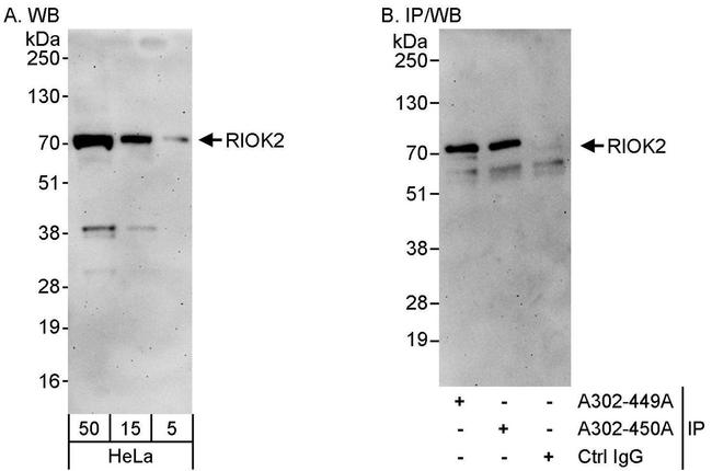 RIOK2 Antibody in Western Blot (WB)