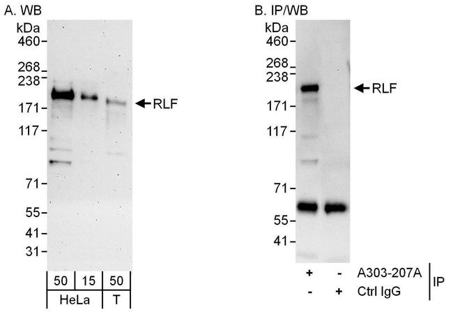 RLF Antibody in Western Blot (WB)
