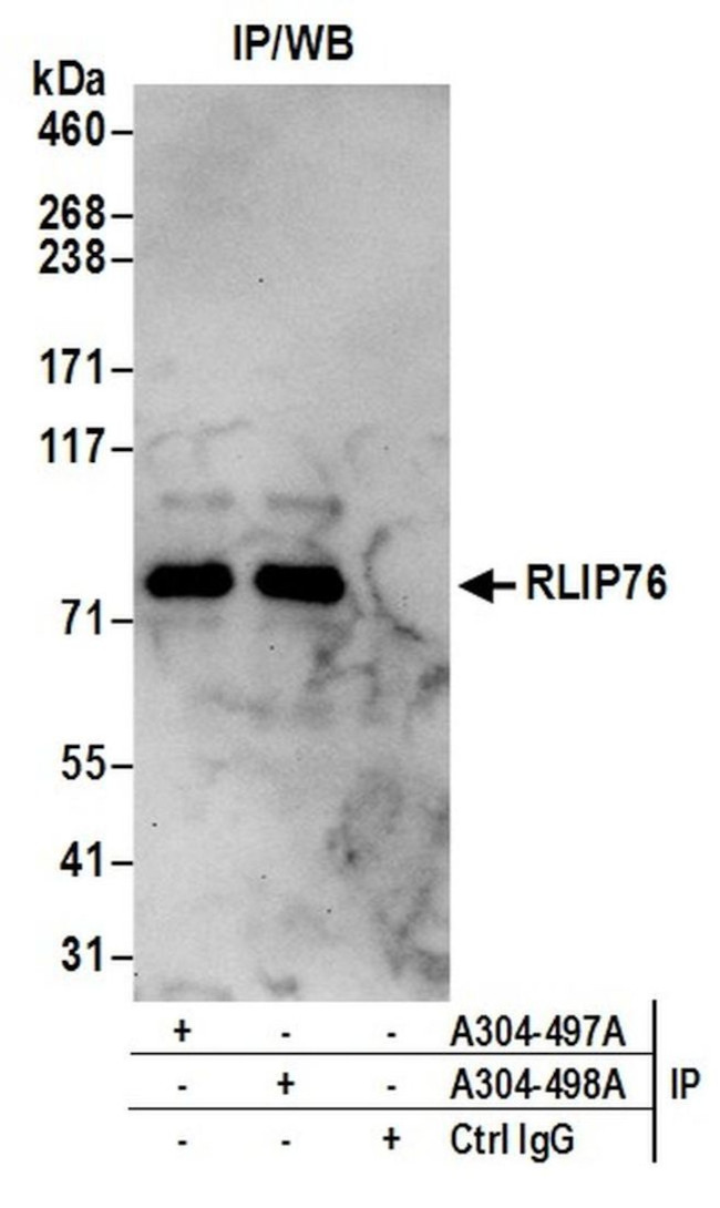 RLIP76 Antibody in Immunoprecipitation (IP)