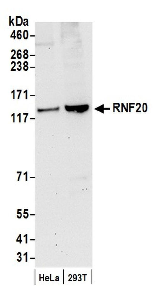 RNF20 Antibody in Western Blot (WB)