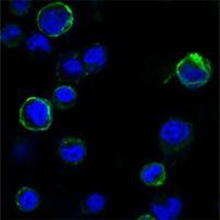 ROR1 Antibody in Immunocytochemistry (ICC/IF)