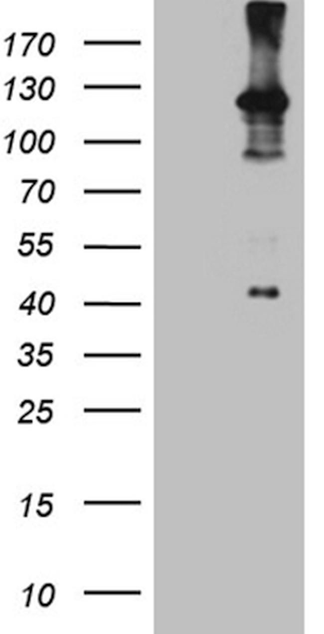 ROR2 Antibody in Western Blot (WB)