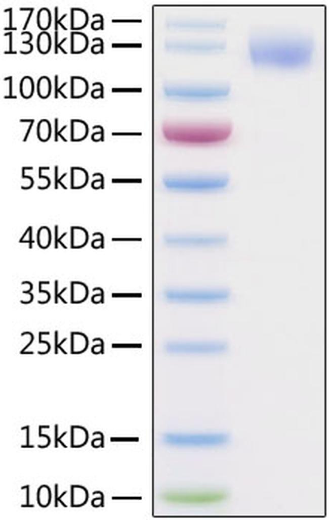 SARS-CoV-2 Spike Protein S1 (aa14-683), His-Avi Tag Protein