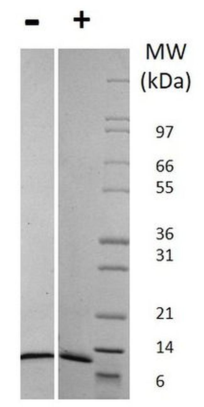 Human CCL2 (MCP-1) Protein