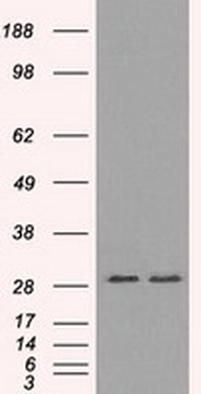RPA2 Antibody in Western Blot (WB)