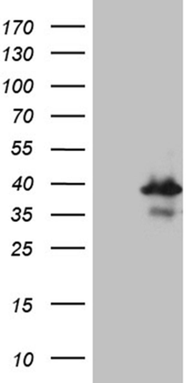 RPAIN Antibody in Western Blot (WB)