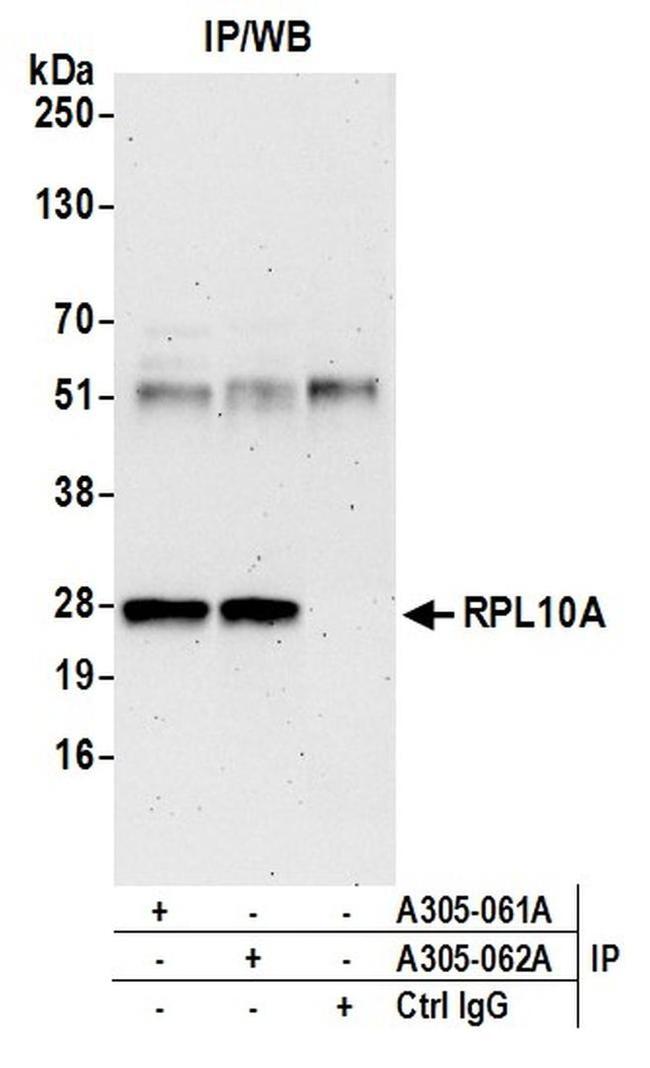 RPL10A/Ribosomal Protein L10a Antibody in Western Blot (WB)