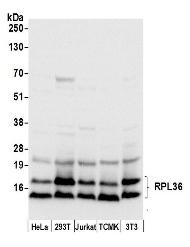RPL36/Ribosomal Protein L36 Antibody in Western Blot (WB)