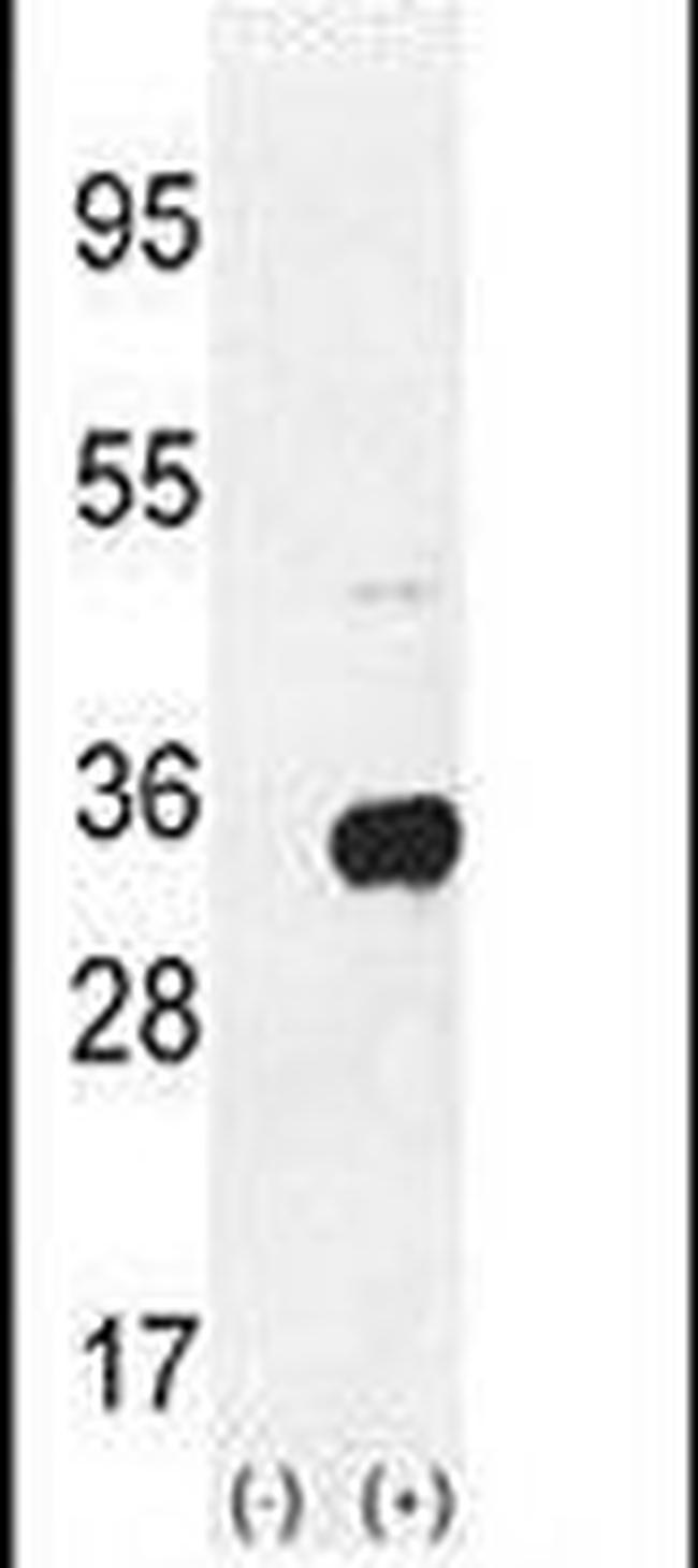 S6 Antibody in Western Blot (WB)