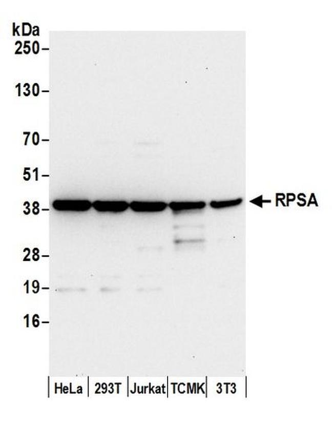 RPSA Antibody in Western Blot (WB)