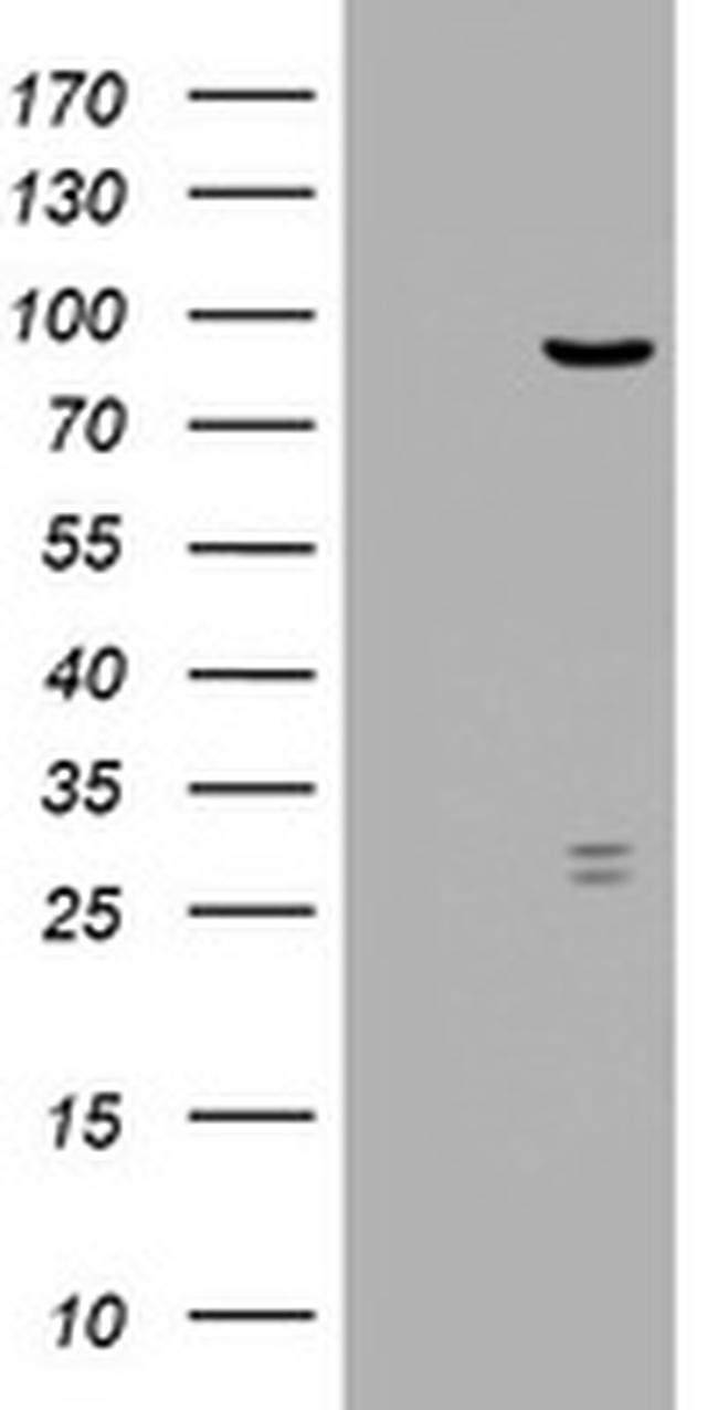 RRM1 Antibody in Western Blot (WB)