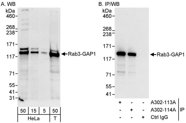 Rab3-GAP1 Antibody in Western Blot (WB)