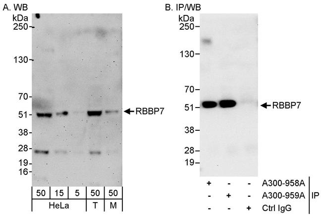 RbBP7 Antibody in Western Blot (WB)