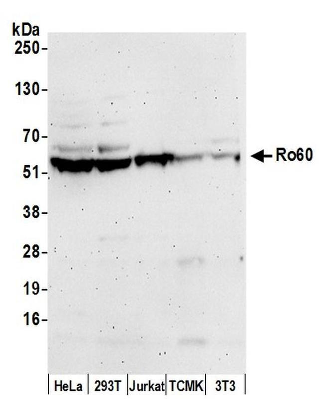 Ro60 Antibody in Western Blot (WB)