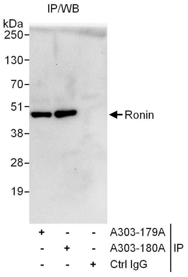 Ronin Antibody in Immunoprecipitation (IP)