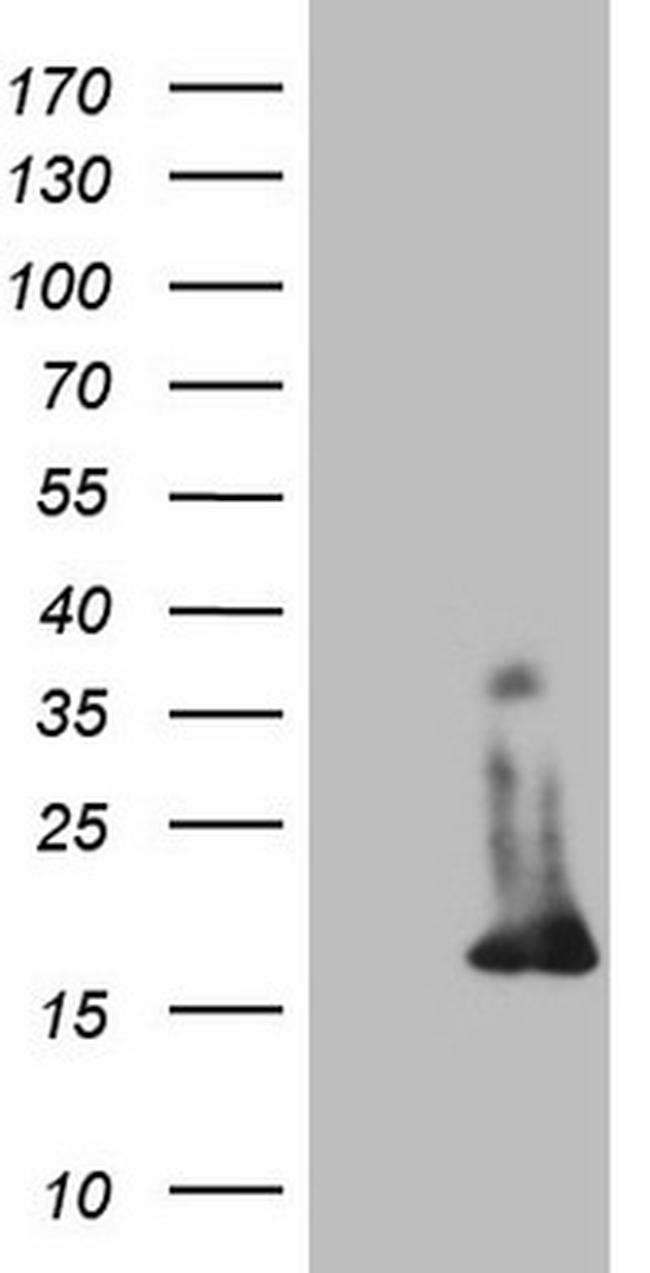 S100A9 Antibody in Western Blot (WB)