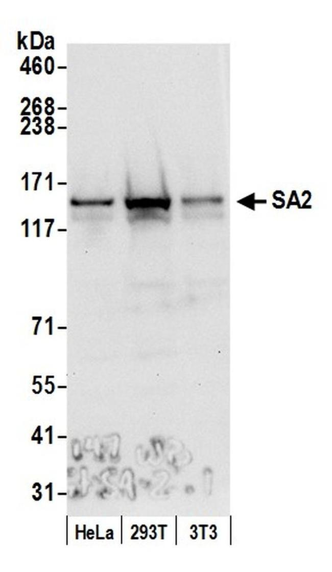SA2 Antibody in Western Blot (WB)