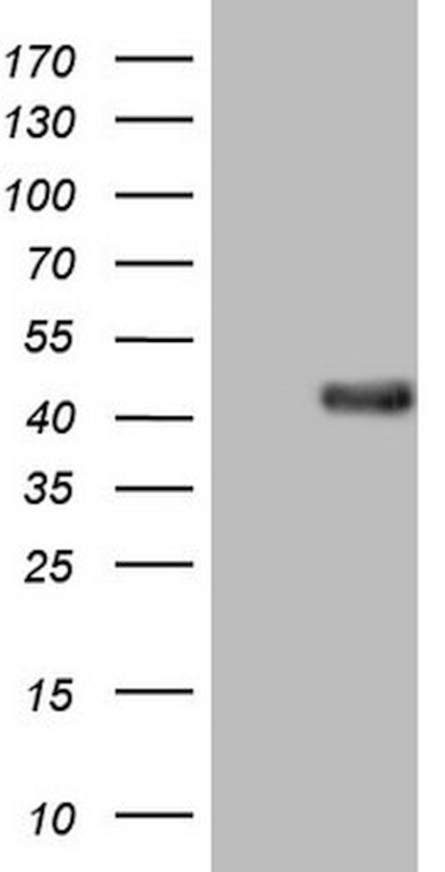 SAE1 Antibody in Western Blot (WB)