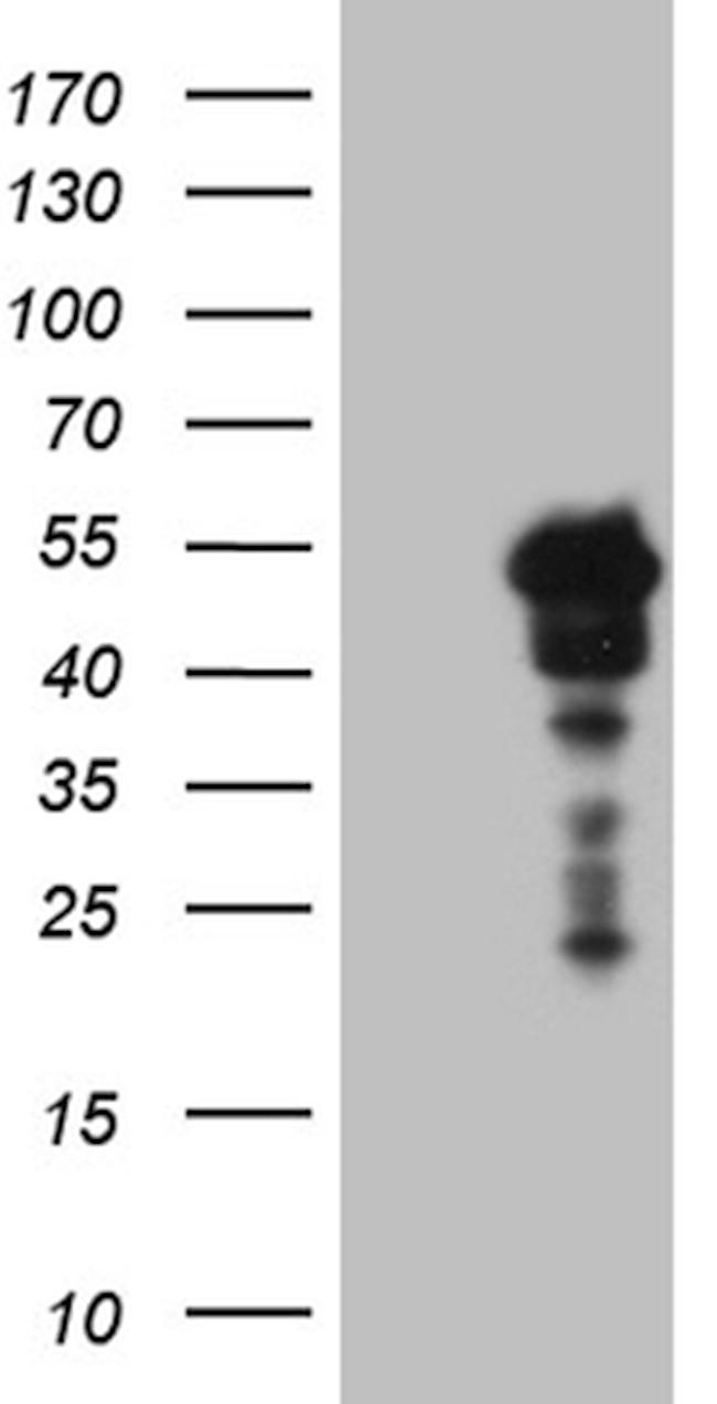 SAMSN1 Antibody in Western Blot (WB)