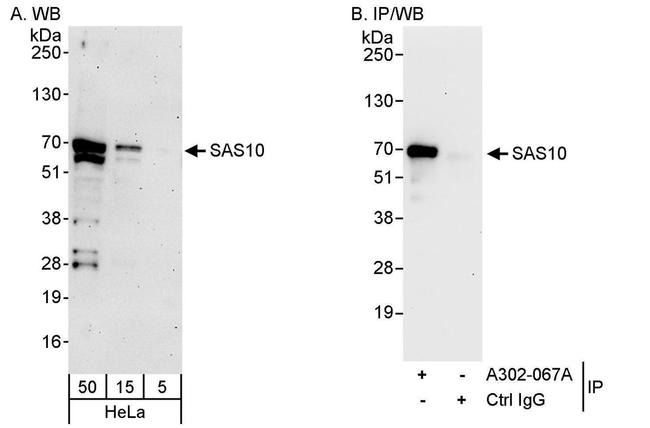 SAS10 Antibody in Western Blot (WB)