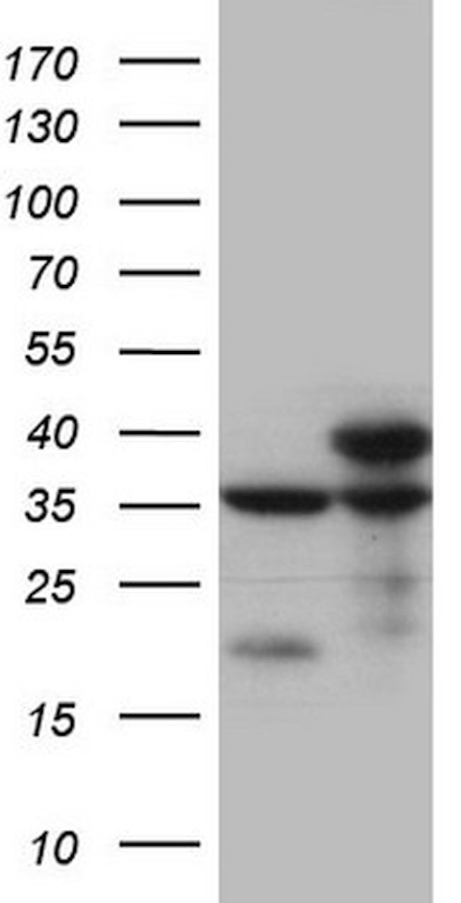 SDHB Antibody in Western Blot (WB)