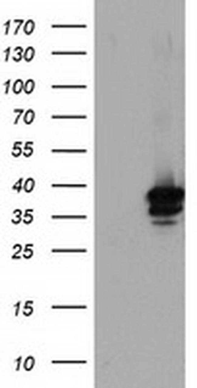 SDS Antibody in Western Blot (WB)