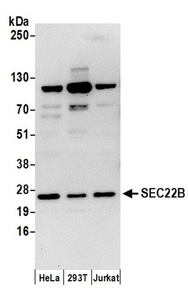 SEC22B Antibody in Western Blot (WB)