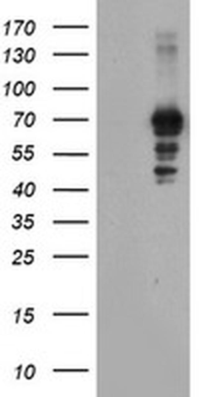 SENP2 Antibody in Western Blot (WB)