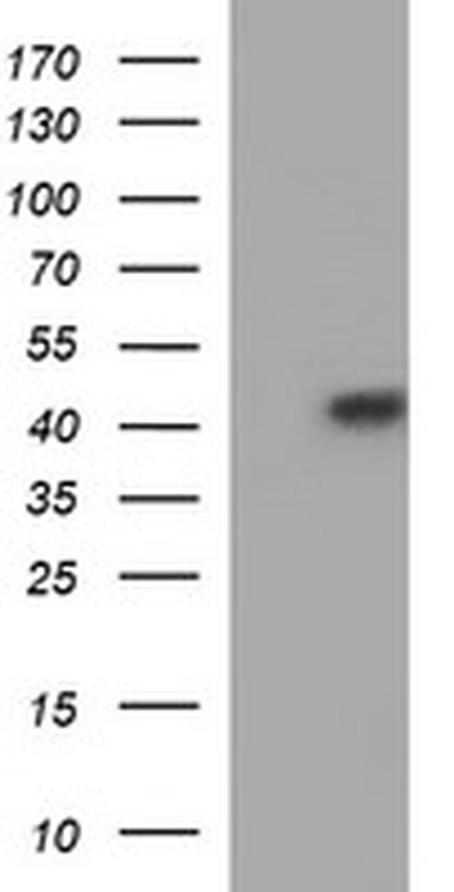 SERPINB3 Antibody in Western Blot (WB)