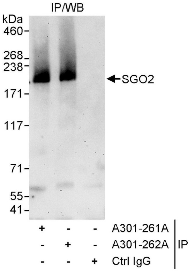 SGO2 Antibody in Immunoprecipitation (IP)