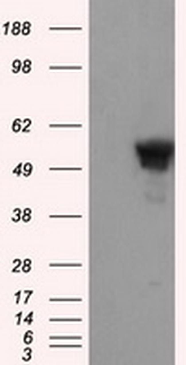 SHC1 Antibody in Western Blot (WB)