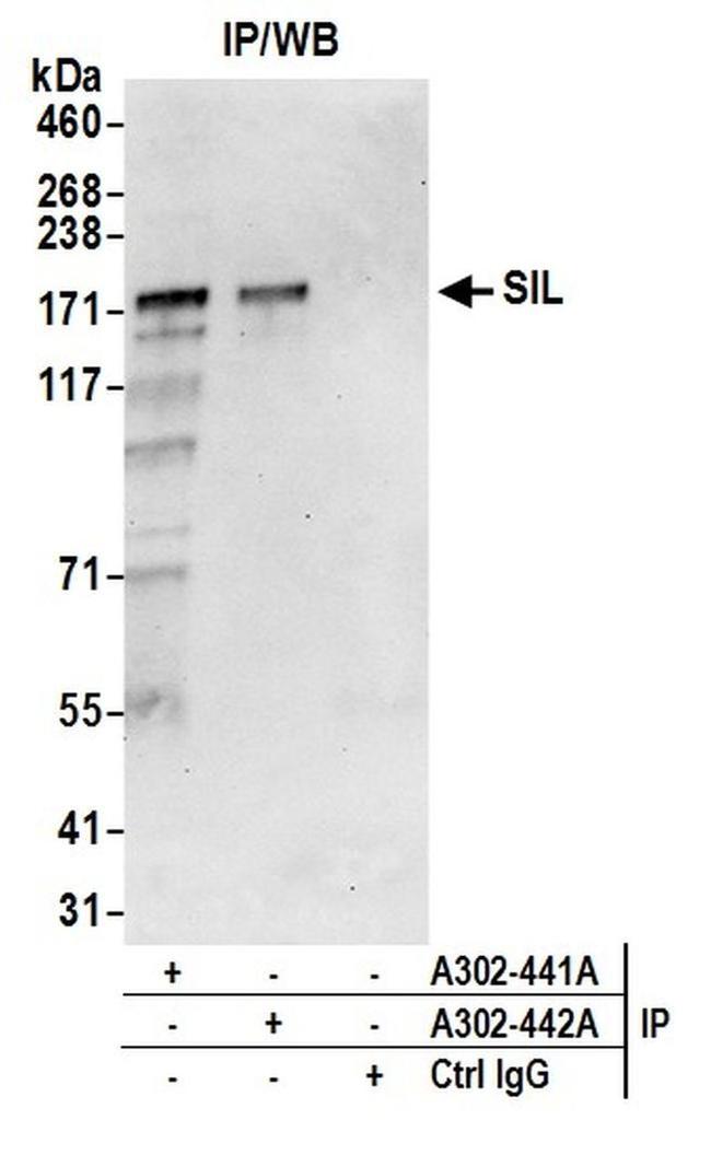SIL Antibody in Western Blot (WB)