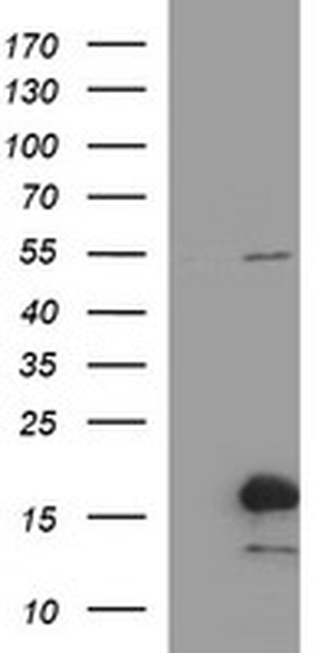 SIVA1 Antibody in Western Blot (WB)
